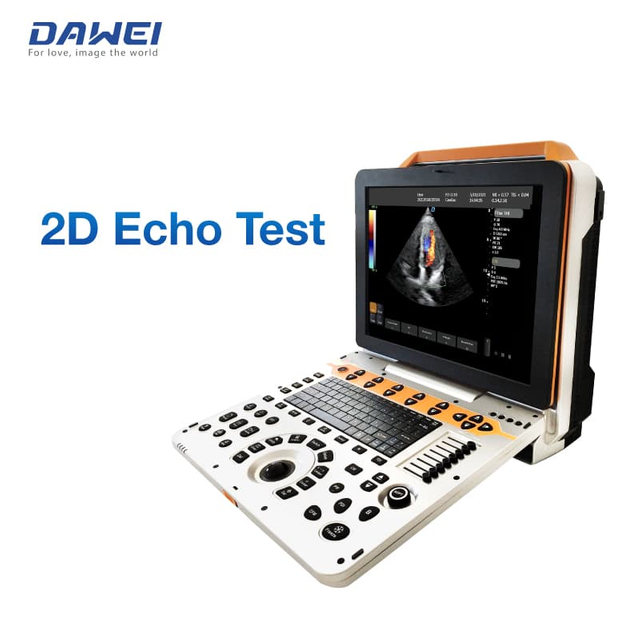 M&aacute;y si&ecirc;u &acirc;m Doppler m&agrave;u cầm tay 3D 4D