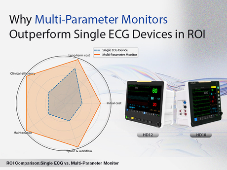 ເປັນຫຍັງ Monitors Multi-Parameter ເຮັດວຽກໄດ້ດີກວ່າອຸປະກອນ ECG ດຽວໃນ ROI .jpg