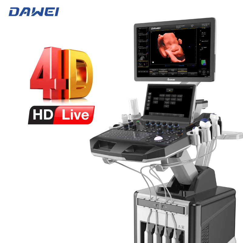 ကိုယ်ဝန်ဆောင်များအတွက် Trolley 4D Ultrasound စကင်နာ