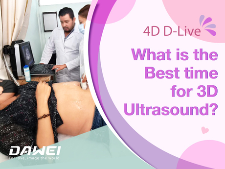 Hvad er det bedste tidspunkt for 3D-ultralyd？-800-600.jpg