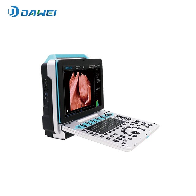 महिला स्वास्थ्यको लागि पोर्टेबल 4D अल्ट्रासाउन्ड मेसिन