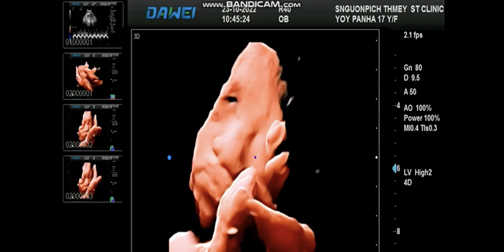 4D Real Skin Foster Imaging 