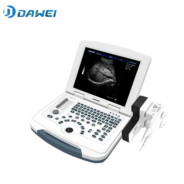 저렴한 가격의 노트북형 흑백초음파 시스템