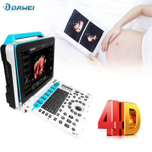 Bolor ultrasunałowy Ob & Gyn 4D
