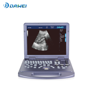 Kaasaskantav PW-funktsiooniga mustvalge ultrahelimasin